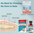 Gonnjunm Multi-Purpose Nail Solution Strengthener Growth Repair Care