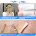 Remover Comedone Extractor Kit 5 Piece — Professional Stainless Steel Pimple & A