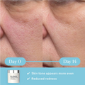 Elemis Dynamic Resurfacing Facial Pads 60pk
