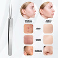 Bewudy 3Pc Stainless Steel Blackhead Remover Tweezers Kit Precision Tool