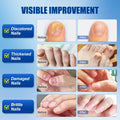 Wunila Toenail Fungus Treatment Extra Strength 30ml Multi-Purpose Nail Repair