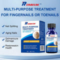 BestBy01/27 Toenail Fungus Treatment Extra Strength with Tolnaftate MultiPurpose