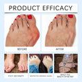 Befada Bunion Cushions Patch Waterproof Adhesive Pads for Men & Women 10 Tablets