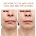 ENROSLU Face Wrinkle Patches 256Pcs Clear Reusable Anti-Wrinkle Treatment