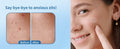 Chic Glamour Emporium Pimple Patch Hydrocolloid Acne Spot Stickers 72 Count