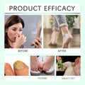 Generic Foot Sanitizer Spray with Tea Tree Oil Clear 1PCS