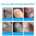 Toenail Fungus Treatment Extra Strength Nail Repair Foot Care